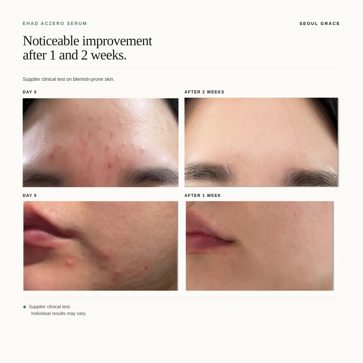 EHAD Aczero Serum