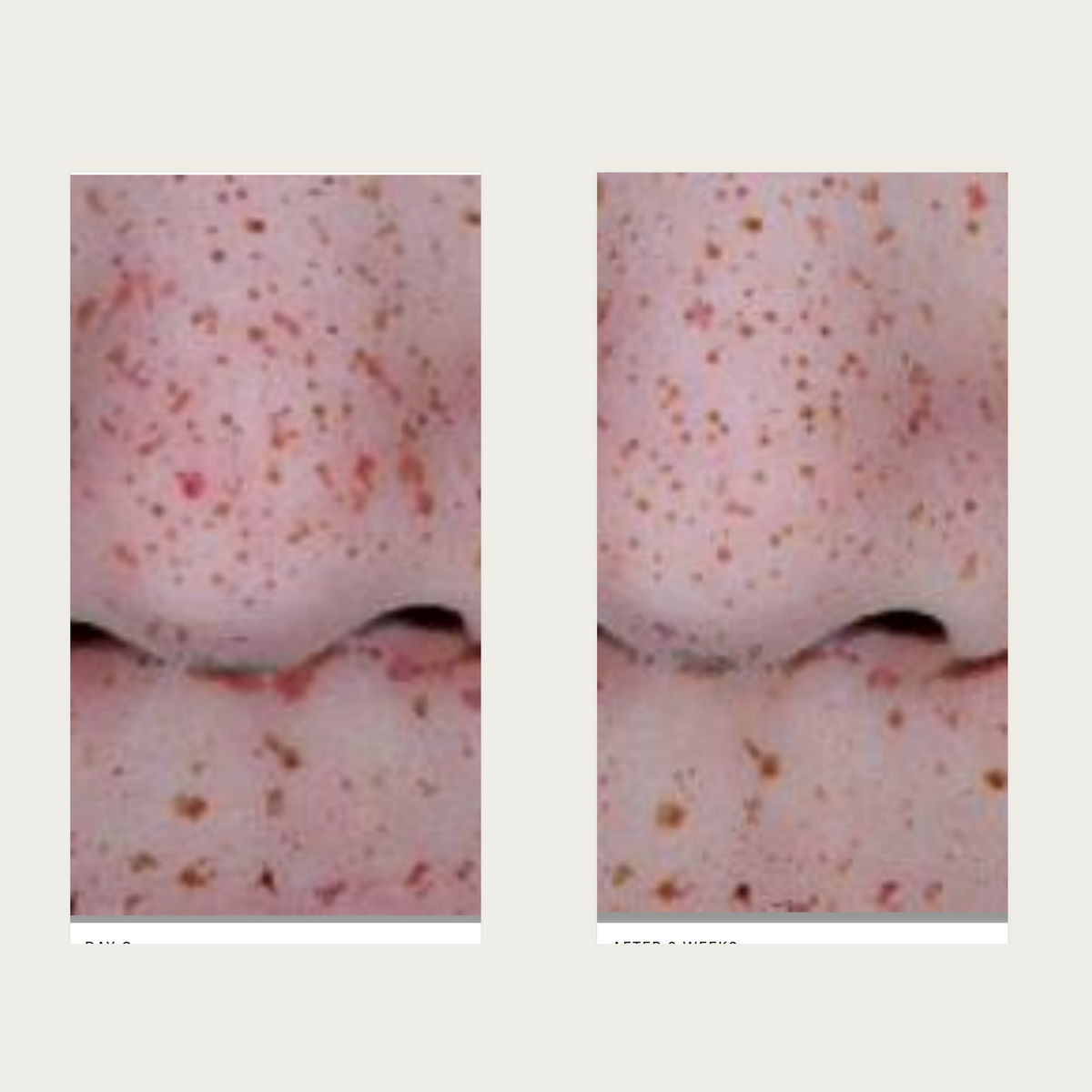 EHAD Brightening Cream dated comparison source