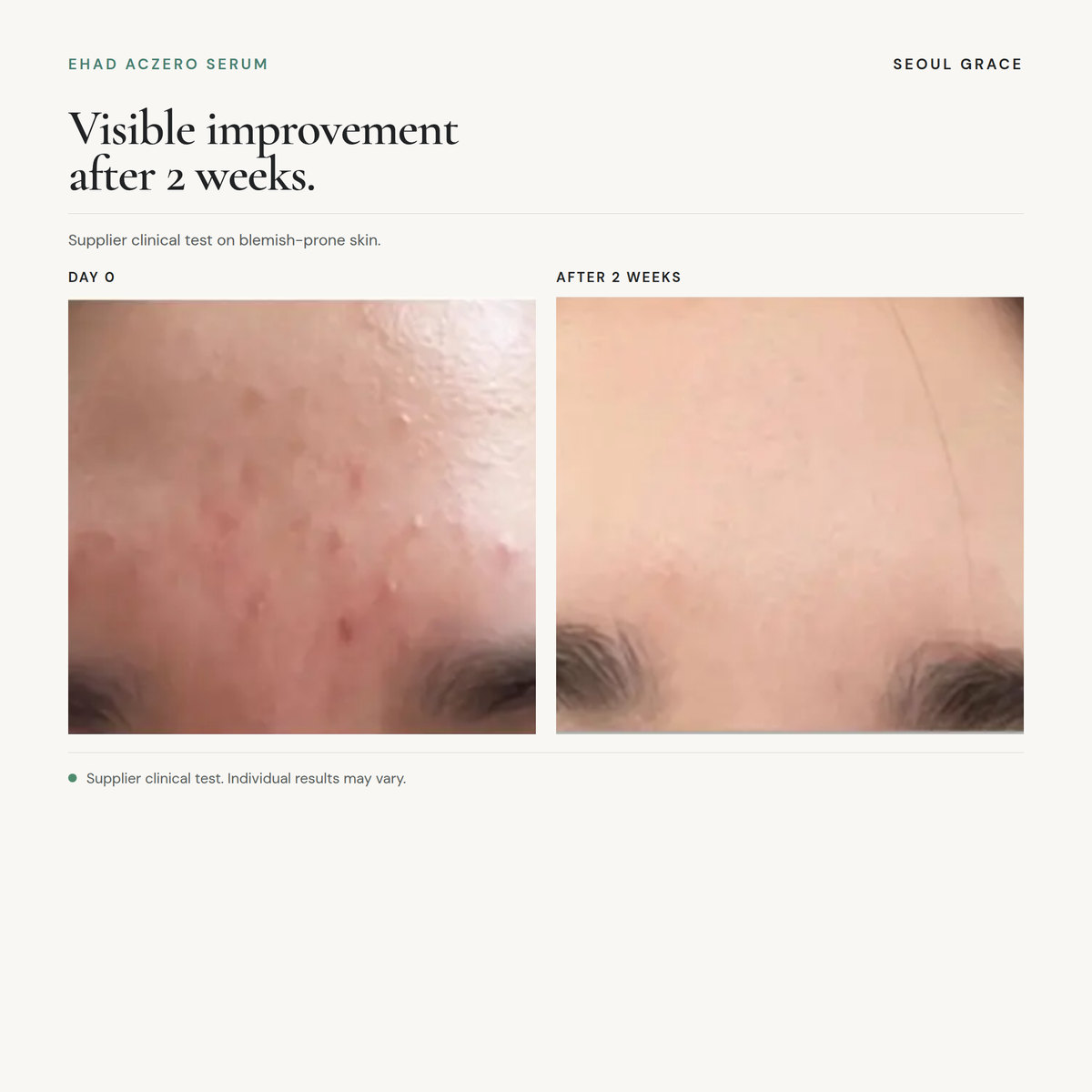 EHAD Aczero Serum