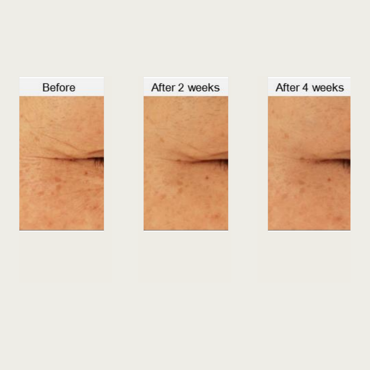 EHAD Eye Wrinkle Pen dated comparison source